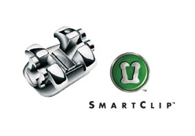 Smartclip Self-ligating Braces